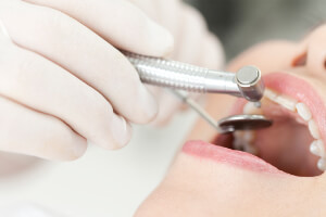 八王子市旭町・八王子旭町デンタルクリニック・STEP 1