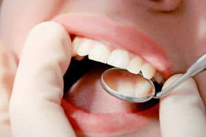 八王子市旭町・八王子旭町デンタルクリニック・STEP 5